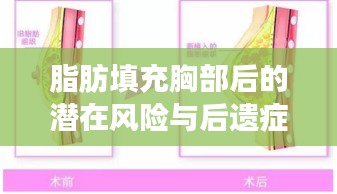 脂肪填充胸部后的潛在風(fēng)險與后遺癥解析