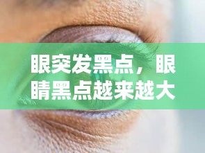 眼突發(fā)黑點(diǎn)，眼睛黑點(diǎn)越來越大 